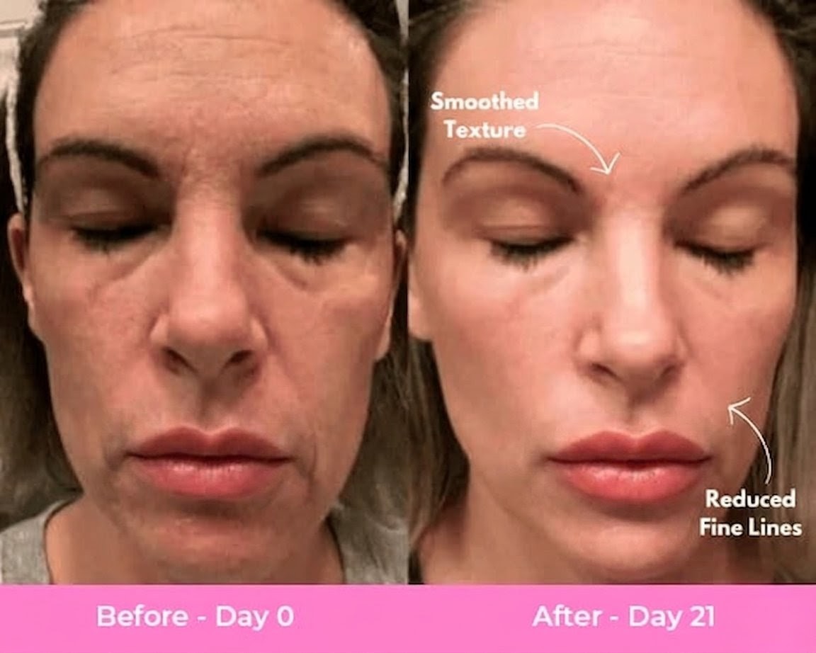 Fovee - Facial Massager