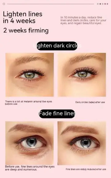 Fovee - Eye Massager